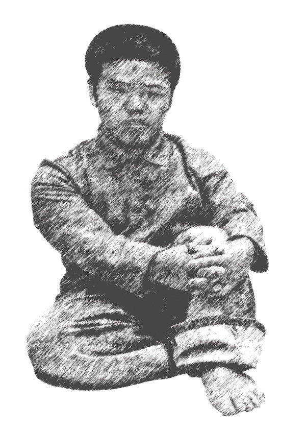 왜소증…이것이 궁금하다