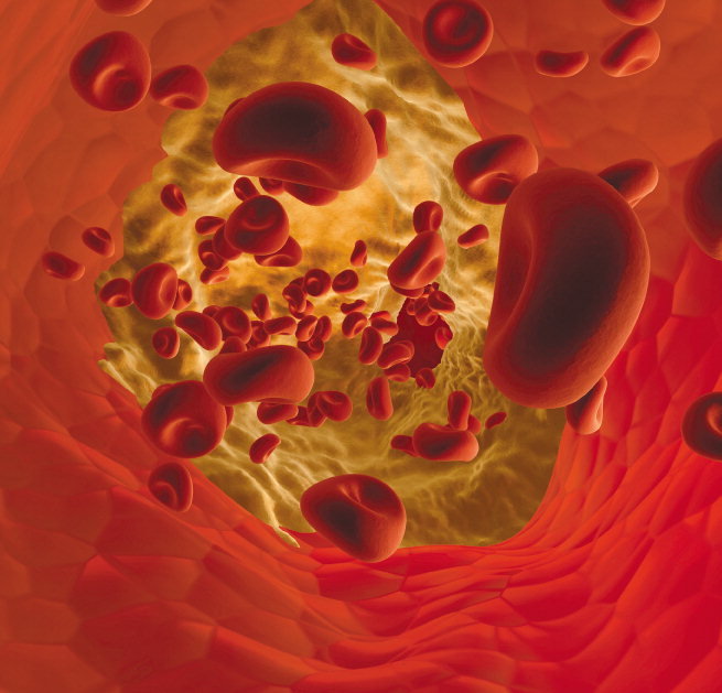 [화제의 질병] 패혈증