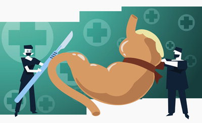 [전문의에게 듣는다] 위암