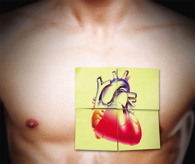 혈관이 풍선처럼 부풀어 오르는 대동맥류 하이브리드 시술로 치료