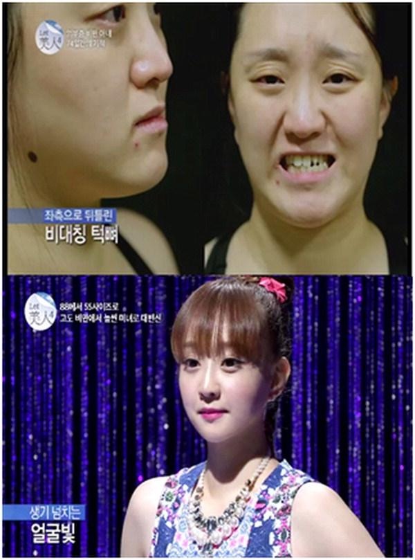 렛미인4 김진, 의부증 아내에서 인형미모 얼짱 엄마로 대변신
