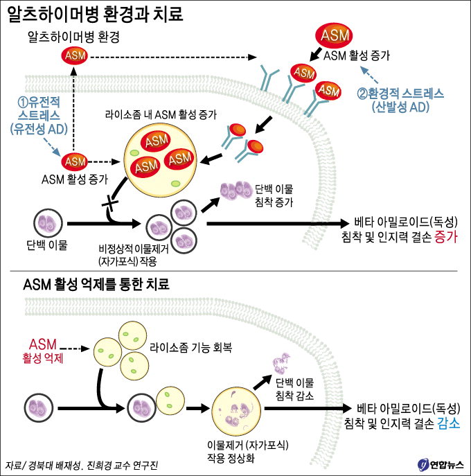 알츠하이머 치료 길 열렸다