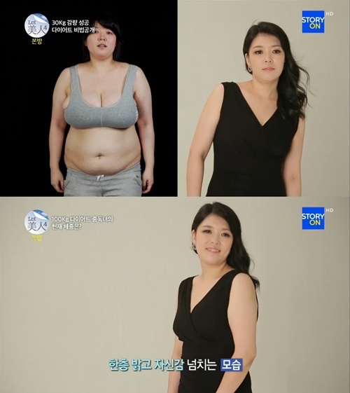 렛미인4 탈락자 김세은, 초고도 비만에서 30kg 감량 대박