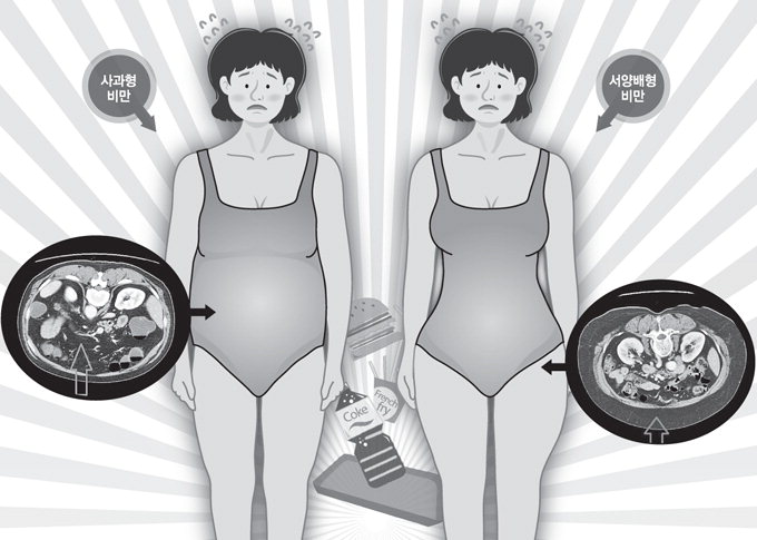 [전문의에게 듣는다] 비만, 배만 부르지 않고 癌도 부른다