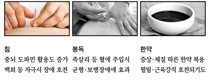 [대구한의대 한방병원의 건강이야기] 운동능력 떨어지는 파킨슨병, 침·봉독·한약치료로 완화