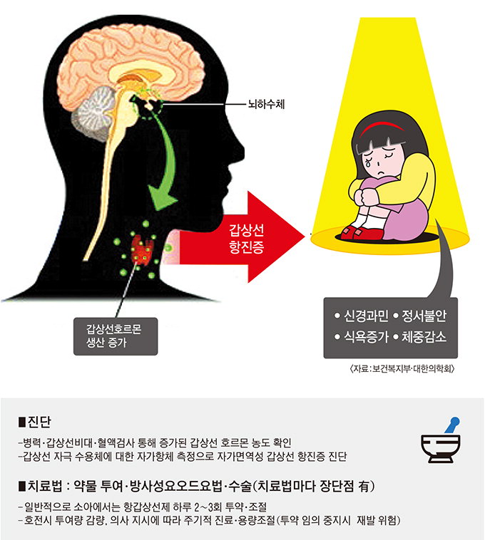 [전문의에게 듣는다] 소아청소년기 갑상선 항진증