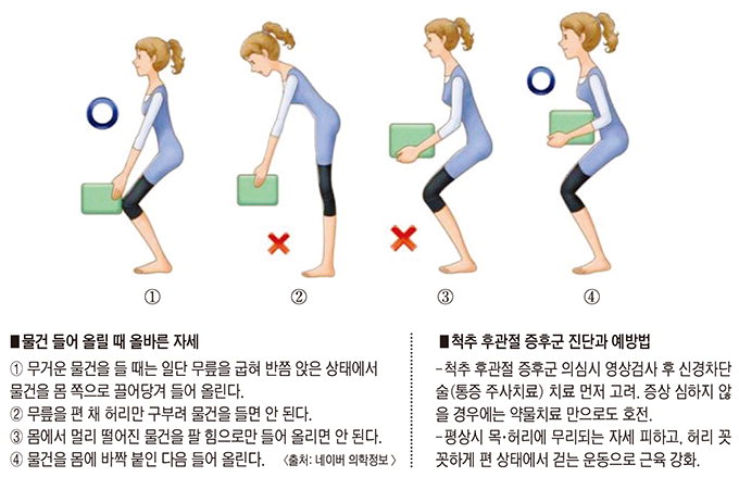 [전문의에게 듣는다] 척추 후관절 증후군
