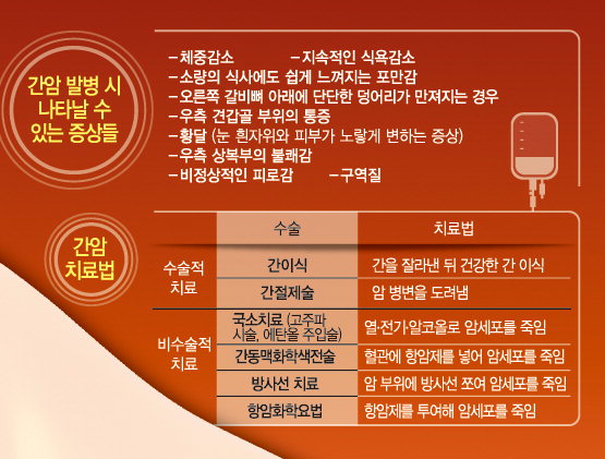 침묵의 간암…“만성 간질환자는 6개월마다 간초음파 검사받아야”