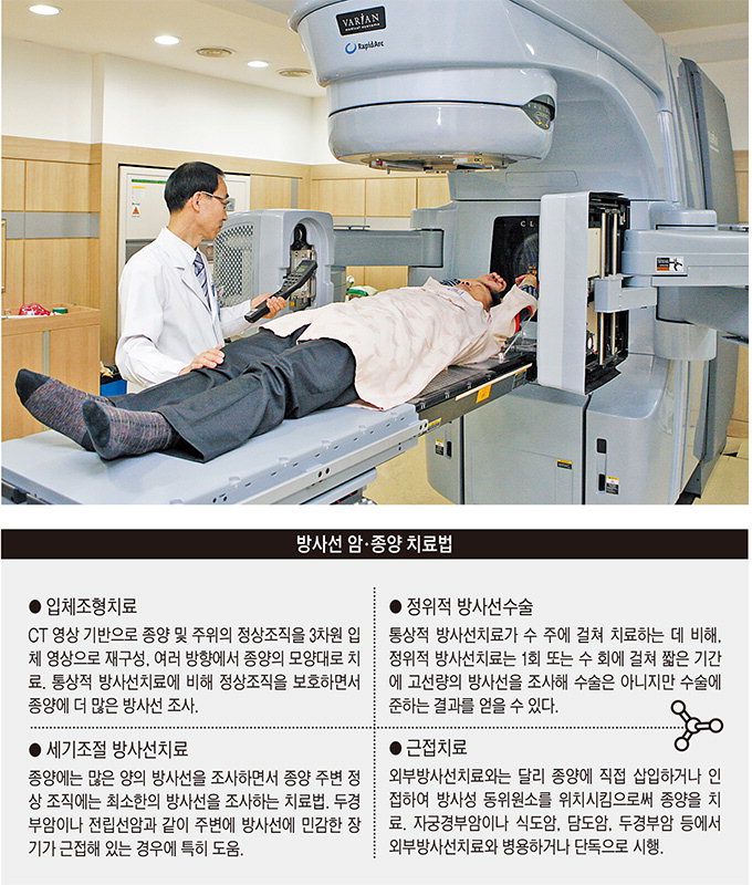 [전문의에게 듣는다] 방사선 암치료
