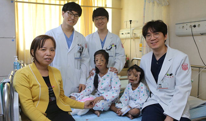 동산병원, 베트남 자매 얼굴기형 수술 지원으로 새 희망 선물