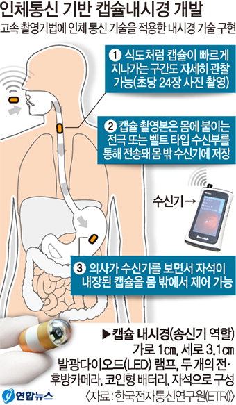 [오늘의 그래픽] 인체통신 기반 캡슐내시경 개발
