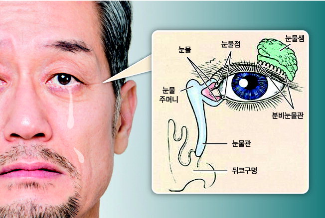 [전문의에게 듣는다] 눈물흘림증