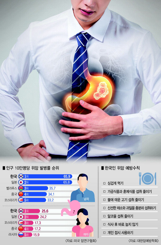 위암 초기 무증상이 80% 이상…조기 발견이 중요