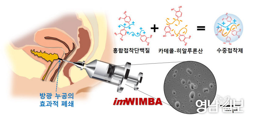 장기에 생긴 구멍, 홍합으로 메운다…포스텍·고려대 연구팀, 방광 누공 치료기술 제시