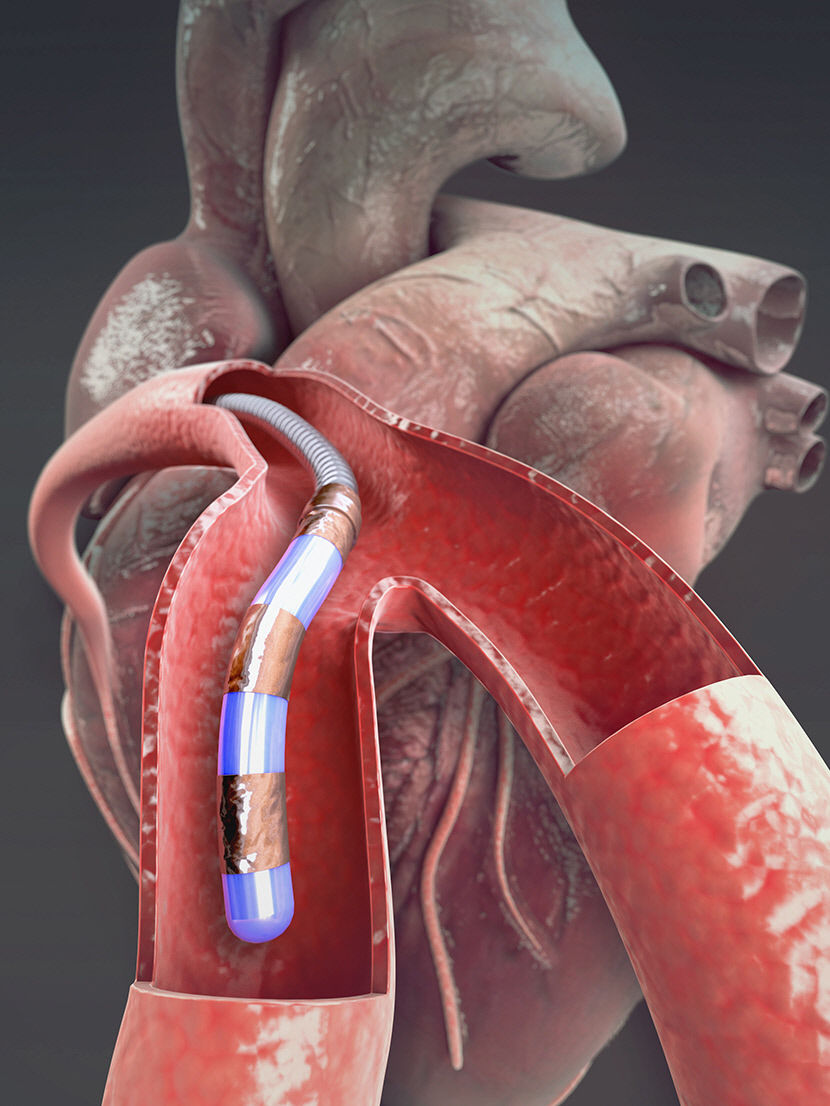 2021040401000121800004772