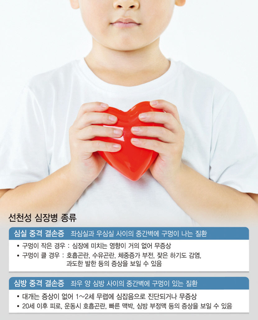 [전문의에게 듣는다] 선천성 심장병…심부전·청색증 나타나면 전문의 진료 받아야
