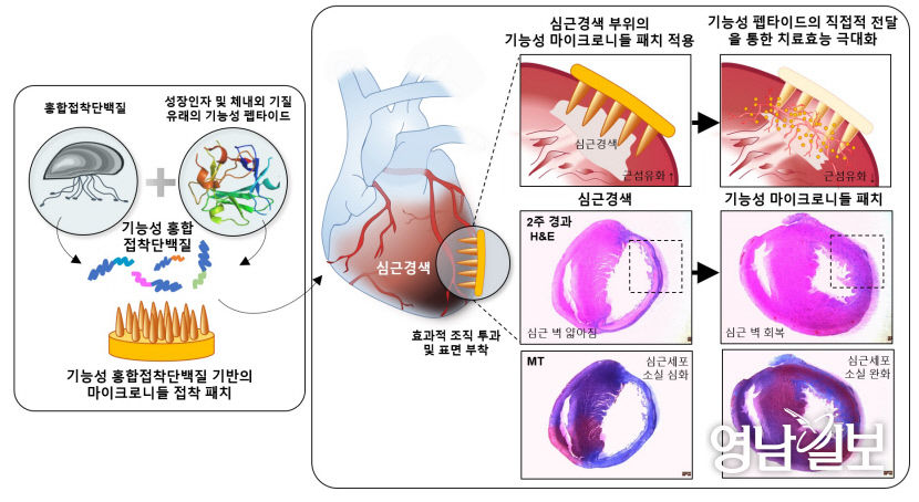 통증 없이 심근경색 치료한다…포스텍 차형준 교수팀, 조직재생용 패치형 주사 개발