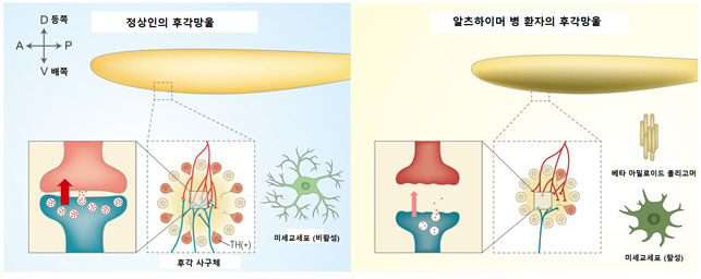 대구 DGIST 문제일 교수 연구팀, 알츠하이머 치매 환자 후각상실 원인 규명