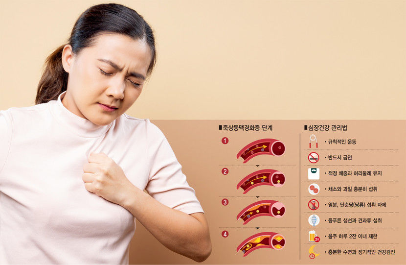 심장혈관 막힌 심근경색 증상…호흡 곤란·구토로 나타날 수도
