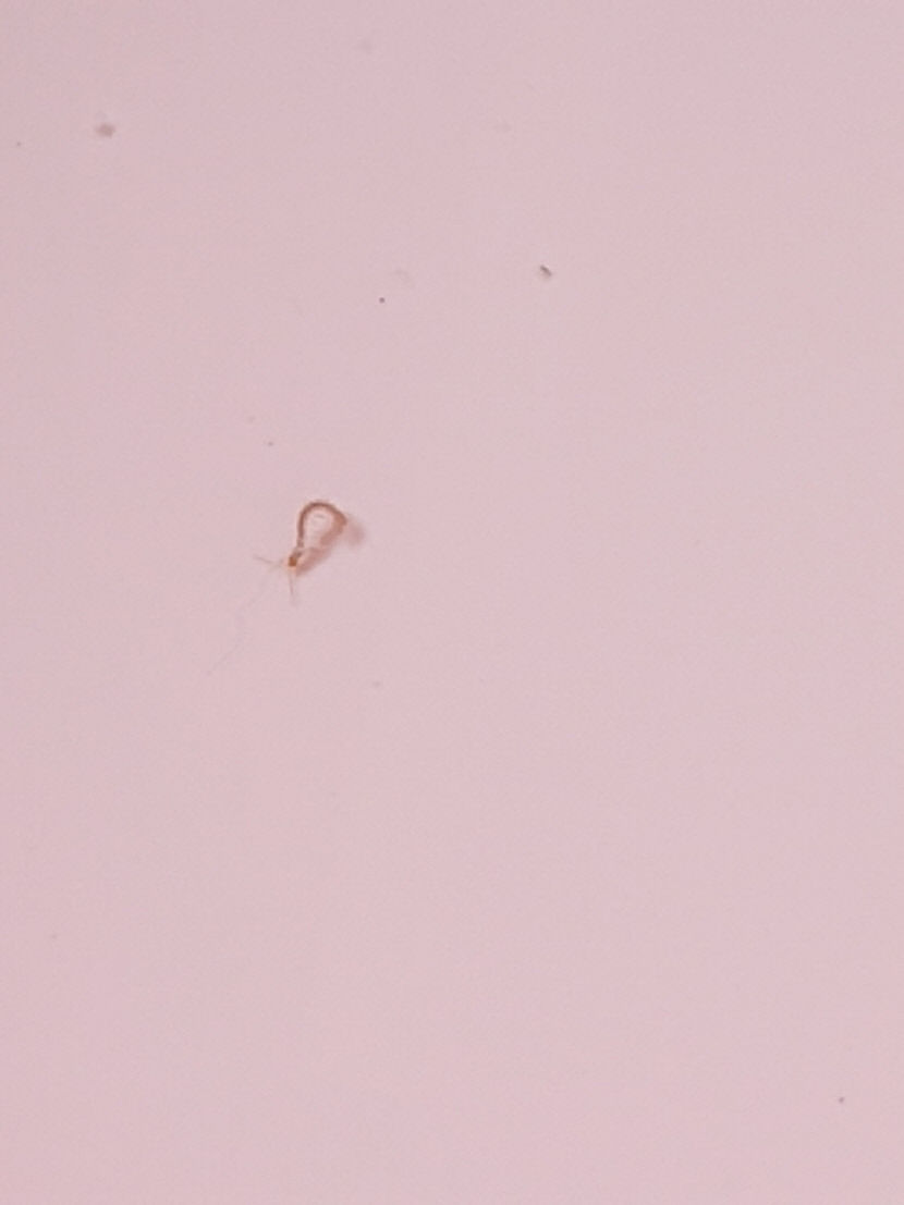 [독자와 함께] 수돗물에서 벌레 발견···어떻게 믿고 마셔요
