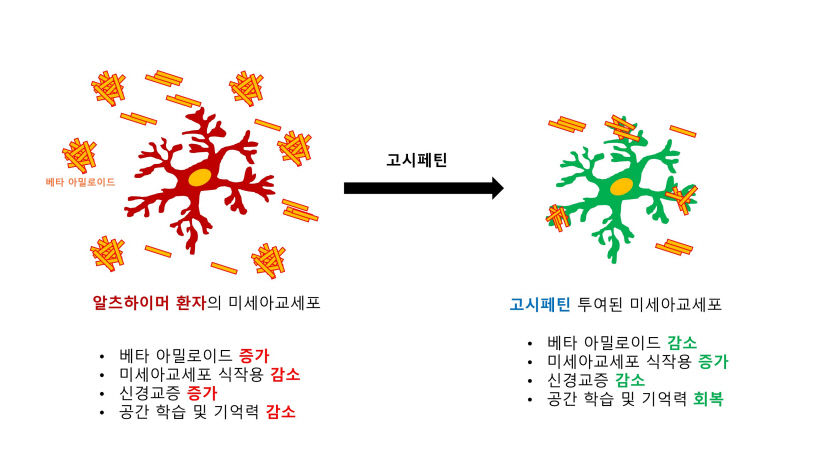 히비스커스로 알츠하이머성 치매 치료제 개발 가능성 열어