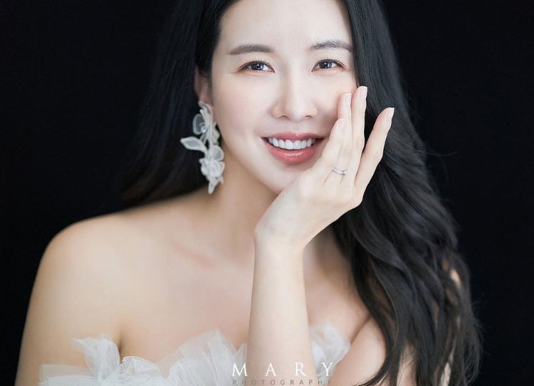 장미인애, 결혼식 앞두고 시부상