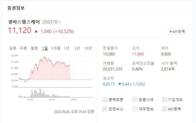 셀바스헬스케어 주가 급등, 美 울트라사이트 JV 설립 중