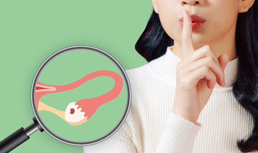 [자각 증상 없는 난소암] 쉿! 침묵하는 난소암, 정기검진만이 예방길