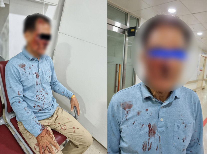 손님한테 맞은 적 있어?…포항 70대 택시기사, 승객에 피투성이
