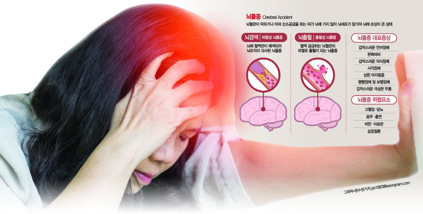 뇌경색도 시간이 생명…골든타임 4시간30분
