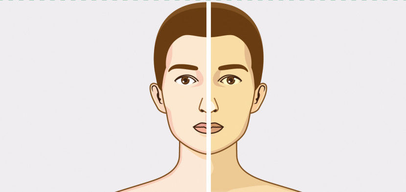 [전문의에게 듣는다] 팽대부 주위암, 황달·붉은 소변에 화들짝…노년층 노리는 침묵의 병
