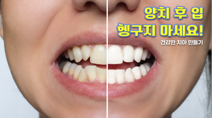 [영상뉴스] 양치 후 헹구지 말라고?