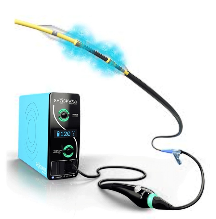 미국 Shockwave Medical사가 개발한 혈관내 쇄석술(IVL) 장비. 저강도 충격파로 관상동맥 내 석회화 병변을 분쇄해 스텐트 확장을 돕는다.<계명대 동산의료원 제공>