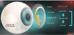 포스텍 연구팀 녹내장 안압 진단·치료 스마트 콘택트렌즈 개발