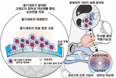 국내 연구팀, 관절염 치료 줄기세포 접착제 개발