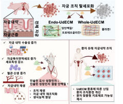 포스텍·차의과학대 공동 연구팀, 자궁 내막 재생 위한 하이드로젤 개발