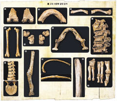 [김대욱 큐레이터와 함께 '考古 go! go!'] 사람의 뼈를 통해 본 옛사람들의 질병②