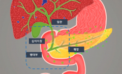[전문의에게 듣는다] 팽대부 주위암, 황달·붉은 소변에 화들짝…노년층 노리는 '침묵의 병'