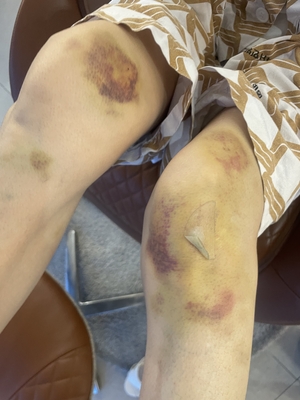[독자와 함께] “골프장 전동차에 끌려가 다쳤는데…” 골프장은 ‘손해배상 책임 없다’