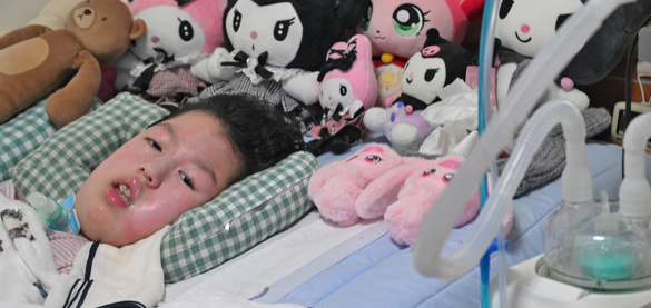 인공호흡기 의존…선천성 근육병증 앓는 13세 효진이